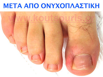 onyxoplastiki 2.jpg