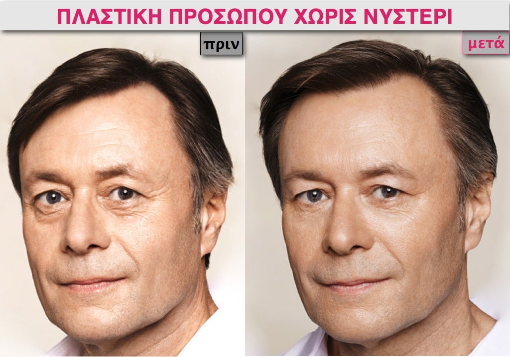 PLASTIKH XORIS NYSTERI GIA ANTRES.001.jpg