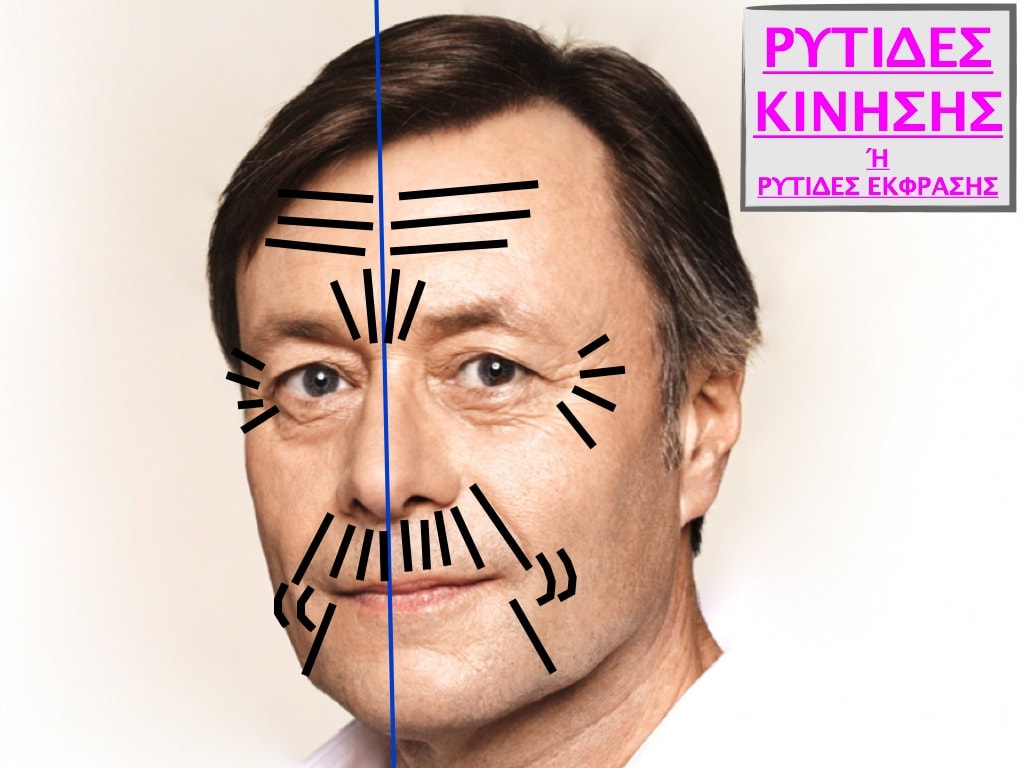 PLASTIKH XORIS NYSTERI GIA ANTRES.003.jpg