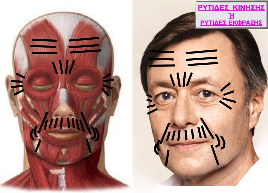 PLASTIKH XORIS NYSTERI GIA ANTRES.004.jpg