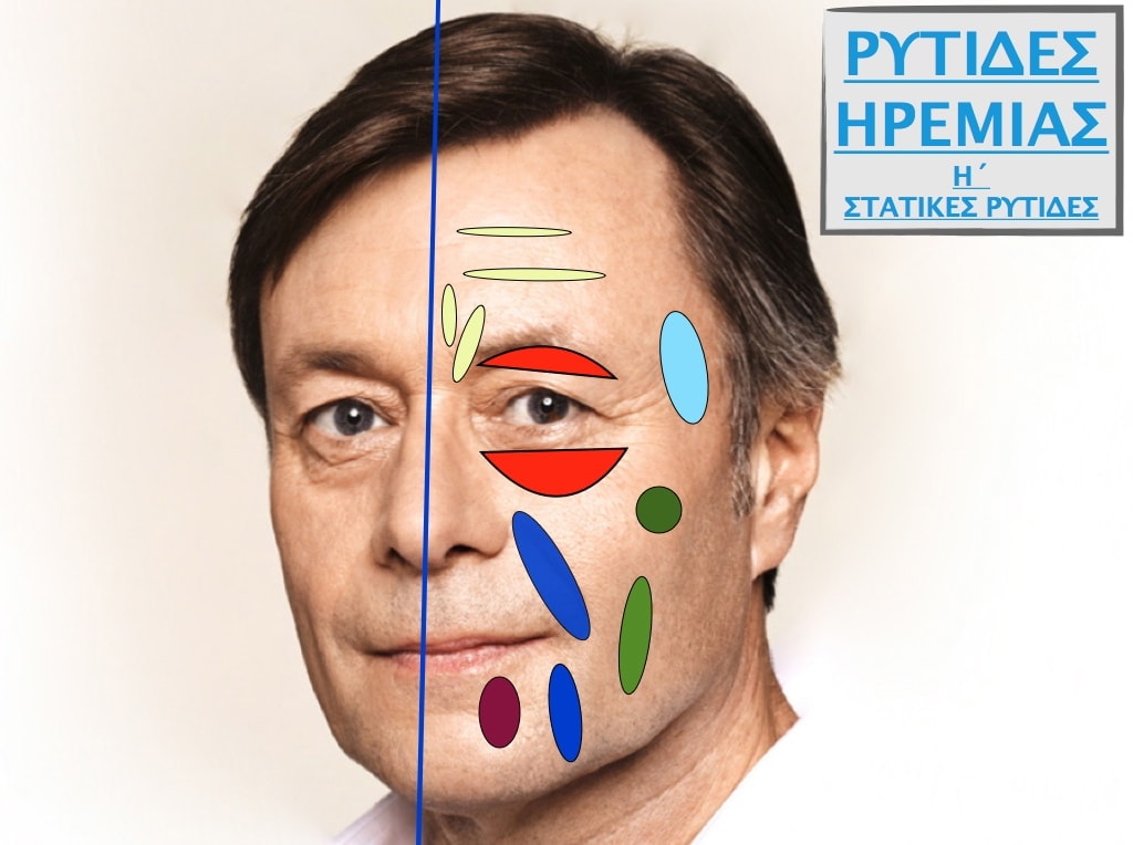 PLASTIKH XORIS NYSTERI GIA ANTRES.005.jpg