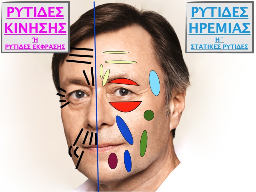 PLASTIKH XORIS NYSTERI GIA ANTRES.006.jpg