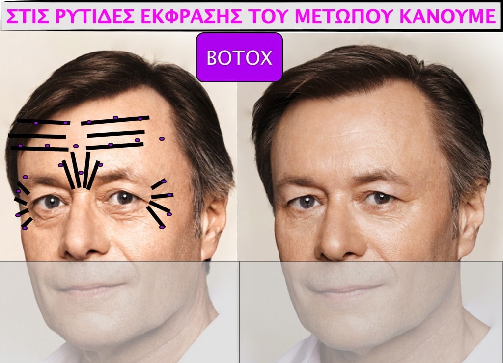 PLASTIKH XORIS NYSTERI GIA ANTRES.007.jpg