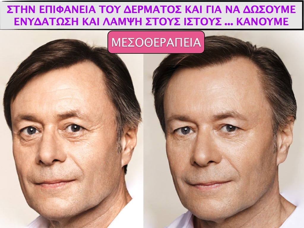PLASTIKH XORIS NYSTERI GIA ANTRES.009.jpg