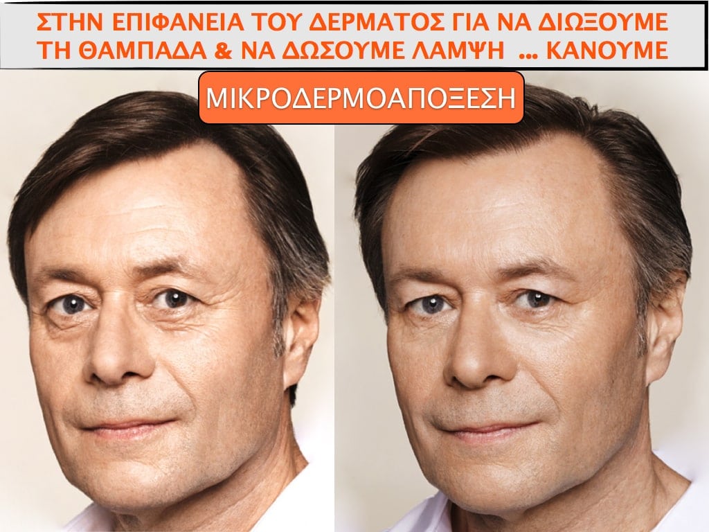 PLASTIKH XORIS NYSTERI GIA ANTRES.010.jpg