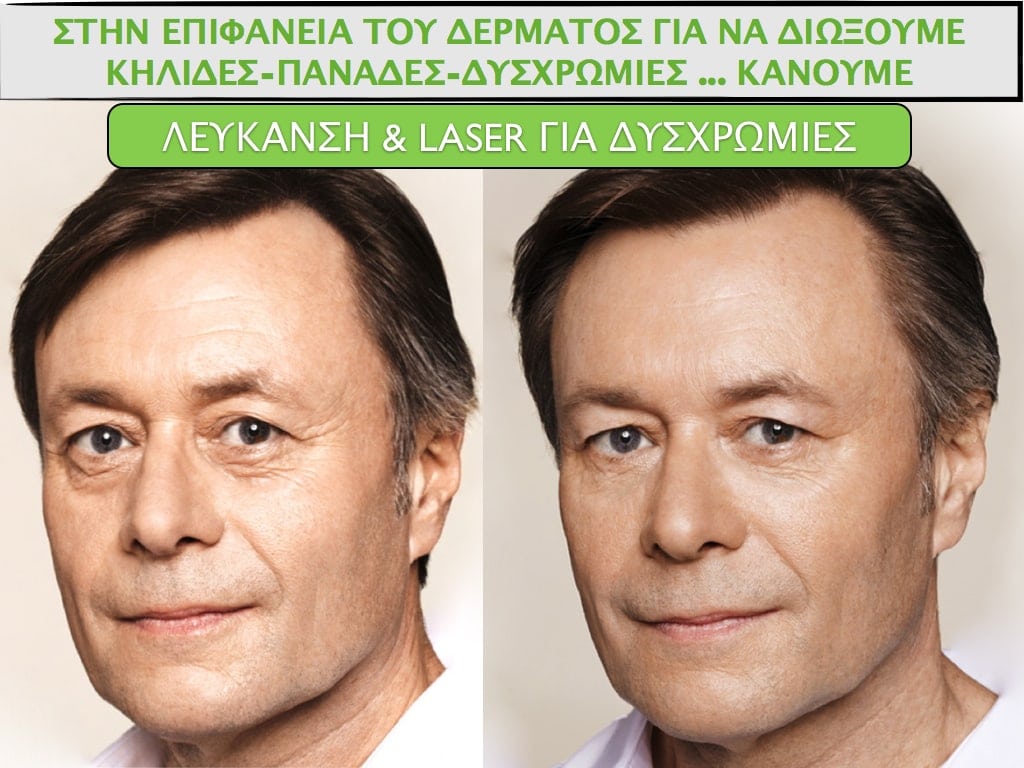 PLASTIKH XORIS NYSTERI GIA ANTRES.011.jpg