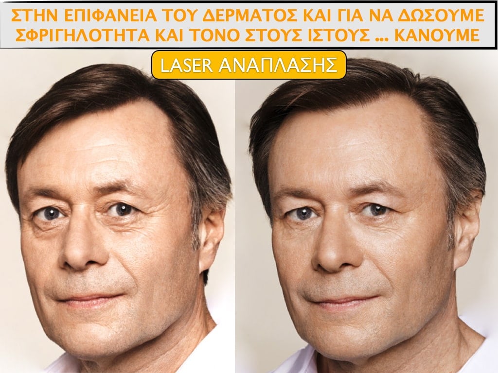 PLASTIKH XORIS NYSTERI GIA ANTRES.012.jpg