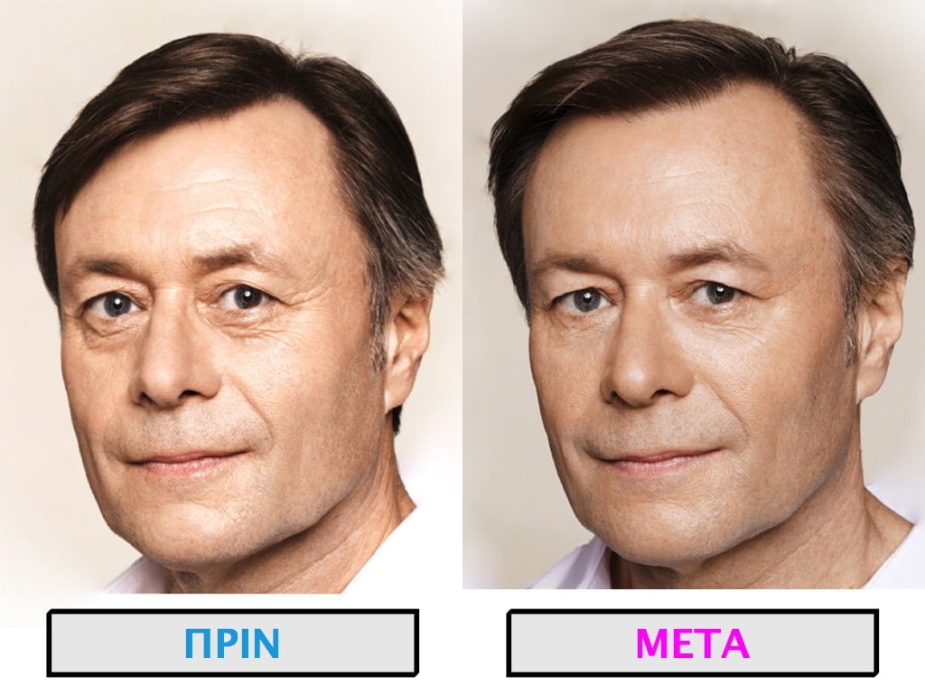 PLASTIKH XORIS NYSTERI GIA ANTRES.013.jpg