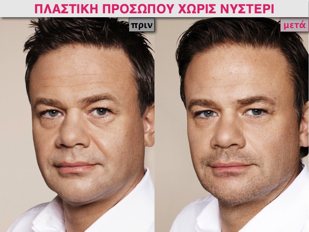 PLASTIKH XORIS NYSTERI GIA ANTRES.019.jpg