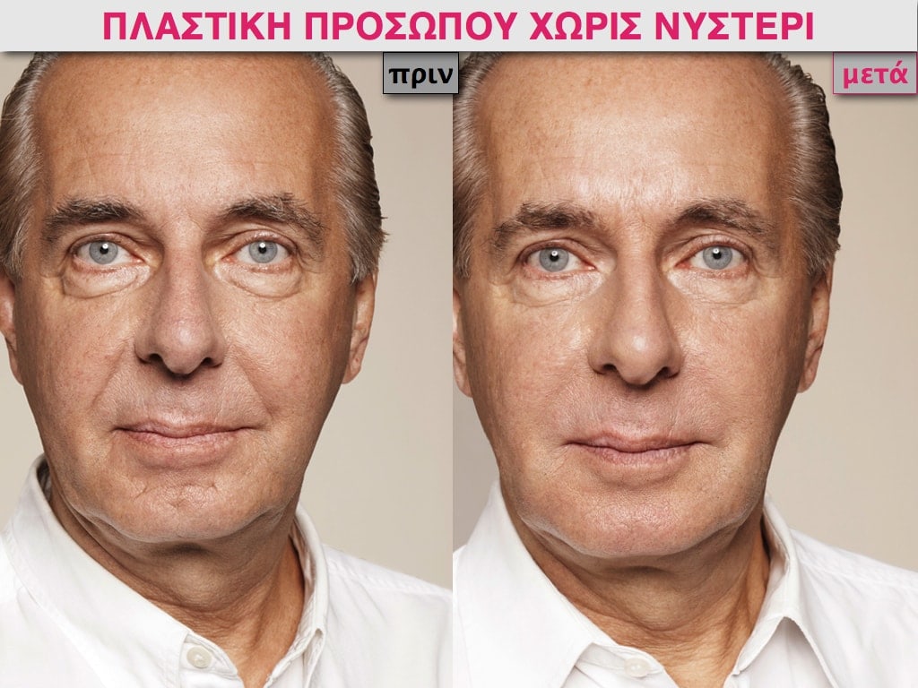 PLASTIKH XORIS NYSTERI GIA ANTRES.020.jpg