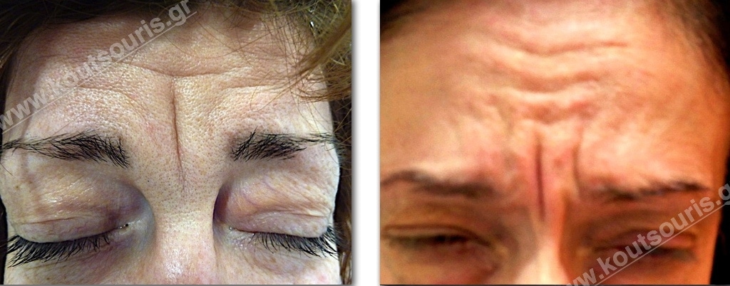 SITE DIORTHOSI MESOFRYOU.001.jpg