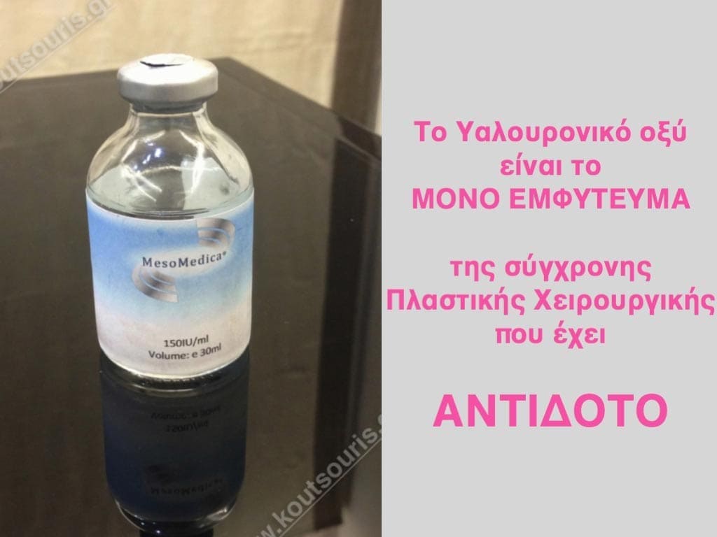 ρινοπλαστική αντιδοτο υαλουρονικό